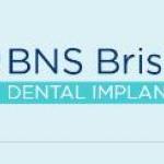 Dental Implants BNS Brisbane Dental Implant Brisbane City